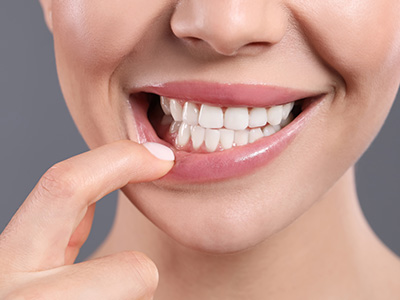 Elite Dentistry | Oral Exams, Intraoral Camera and Inlays  amp  Onlays