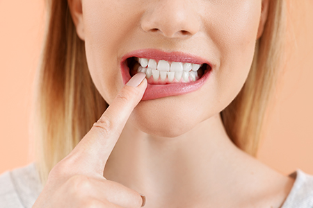 Elite Dentistry | Full Mouth Reconstruction, CBCT and Implant Dentistry